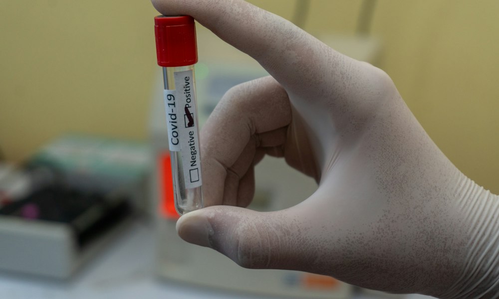 Метаболіти Мастерон пропіонат: як організм розщеплює препарат — ілюстрація